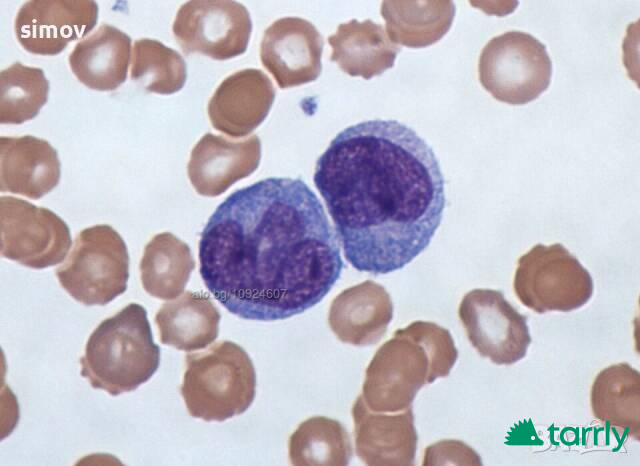 Снимка номер 1 за Азур-еозин по Романовски 99 прах-багрило за микроскопскопия.